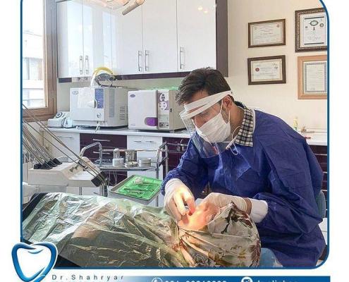 متخصص لثه و ایمپلنت دندان در ونک تهران