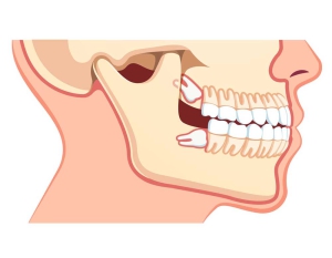 درد دندان 